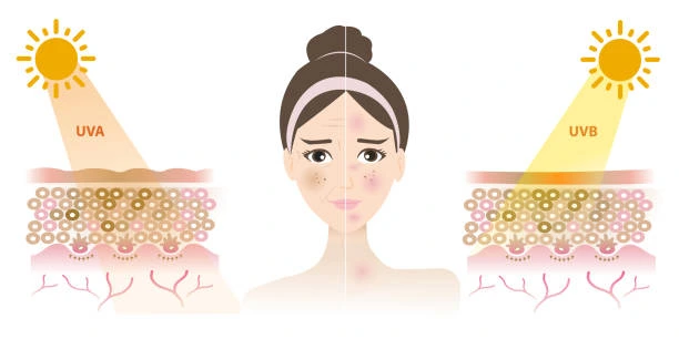 Understanding Sun Damage Winchester : How Do UV Rays Cause Changes in the Skin? Winchester